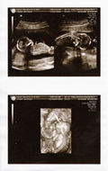 Twins scan